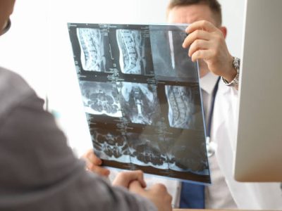 Doctor hold xray bone spine radiography in hand. Examination and treatment of intervertebral hernia. Traumatology tomography hospital radiographer concept.