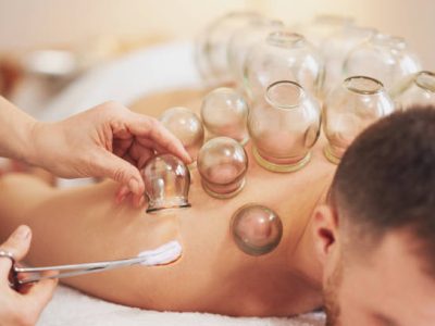 A picture of a man having cupping therapy. High quality photo