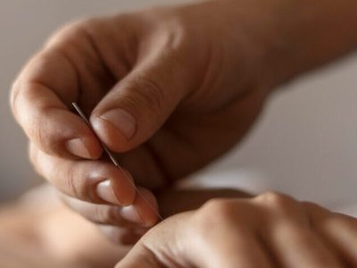 mano-primer-plano-sosteniendo-aguja-acupuntura